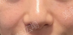 治療前の症例写真