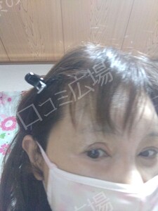 治療前の症例写真