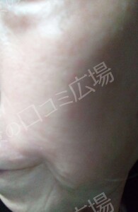 治療結果の症例写真