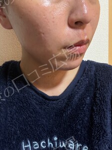 治療前の症例写真