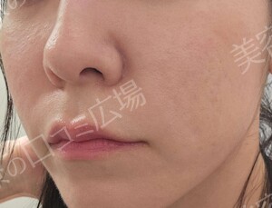 治療前の症例写真