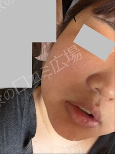 治療前の症例写真