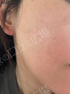 治療結果の症例写真