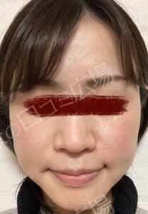 治療前の症例写真
