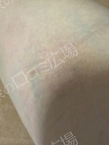 治療結果の症例写真