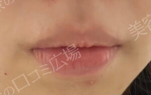 治療前の症例写真