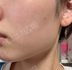 治療結果の症例写真