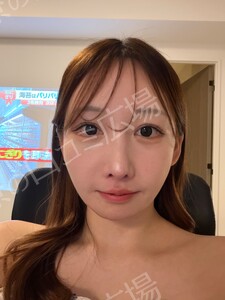 治療結果の症例写真
