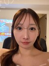 施術後の状態