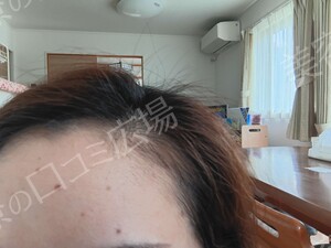 治療前の症例写真