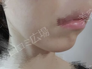 治療前の症例写真