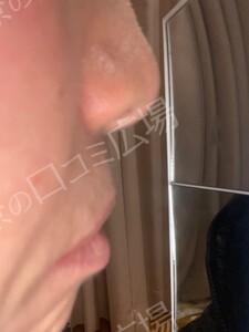 治療前の症例写真