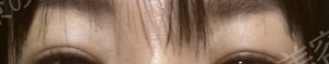治療結果の症例写真