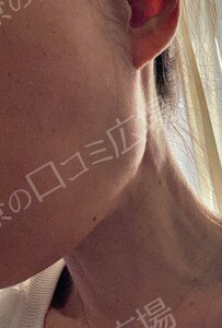 治療結果の症例写真