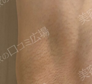 治療結果の症例写真