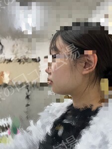 治療結果の症例写真