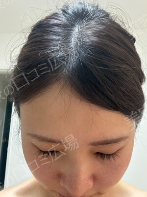 THE CLINIC NAGOYA 【ザ・クリニック名古屋】の症例写真[アフター]