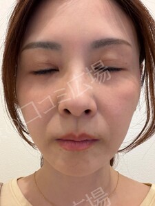 治療結果の症例写真