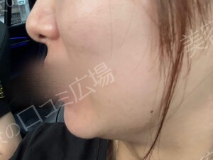 治療結果の症例写真