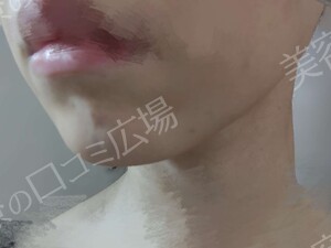 治療前の症例写真