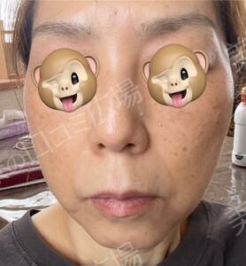治療前の症例写真