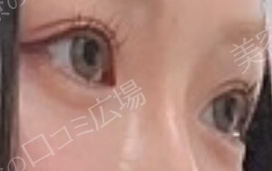 治療結果の症例写真