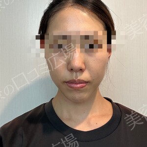 治療結果の症例写真