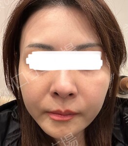 治療前の症例写真