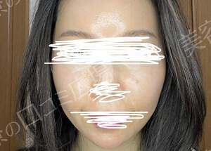 治療前の症例写真