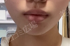 治療結果の症例写真