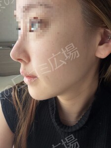 治療結果の症例写真