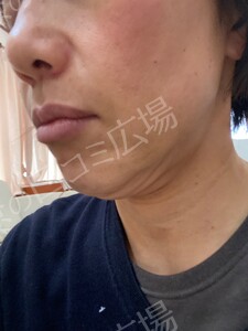 治療結果の症例写真
