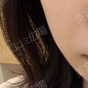 治療前の症例写真