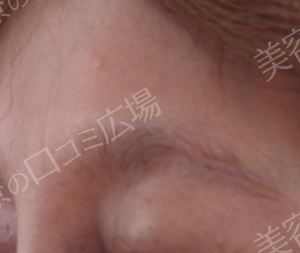 治療結果の症例写真