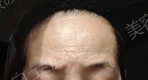 治療前の症例写真