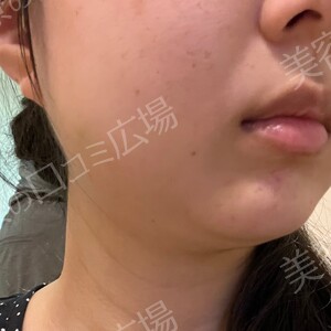 治療前の症例写真