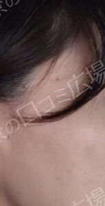 治療前の症例写真