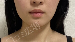 治療結果の症例写真