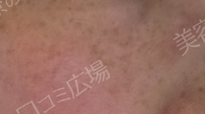 治療前の症例写真