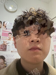 治療前の症例写真