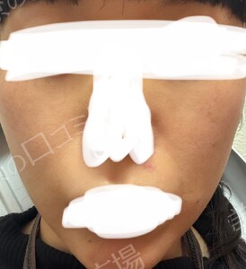 治療結果の症例写真