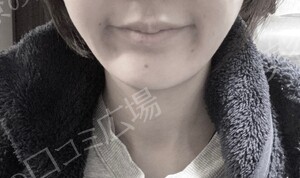 治療結果の症例写真