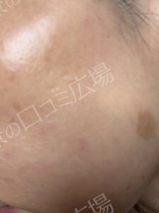 治療結果の症例写真