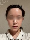 施術後の状態