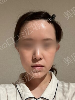 新宿ラクル美容外科クリニックの症例写真[アフター]