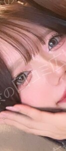 治療前の症例写真