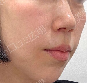 治療前の症例写真