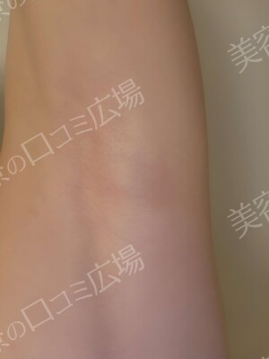 THE CLINIC NAGOYA 【ザ・クリニック名古屋】の症例写真[アフター]