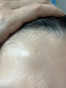 治療結果の症例写真