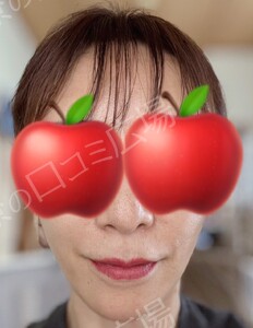 治療結果の症例写真